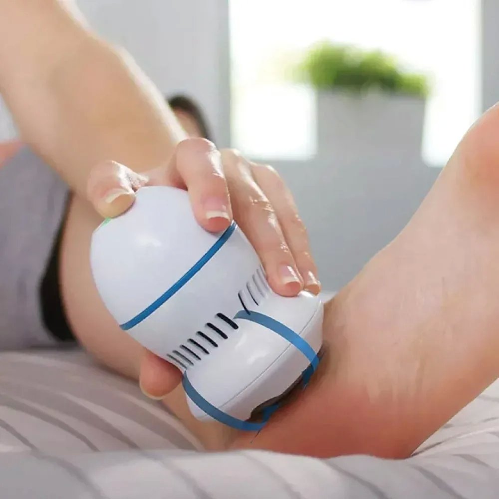 Dispositivo Elettrico per Pedicure – Rimozione Calli e Pelle Morta Ricaricabile con Testina Lucidante