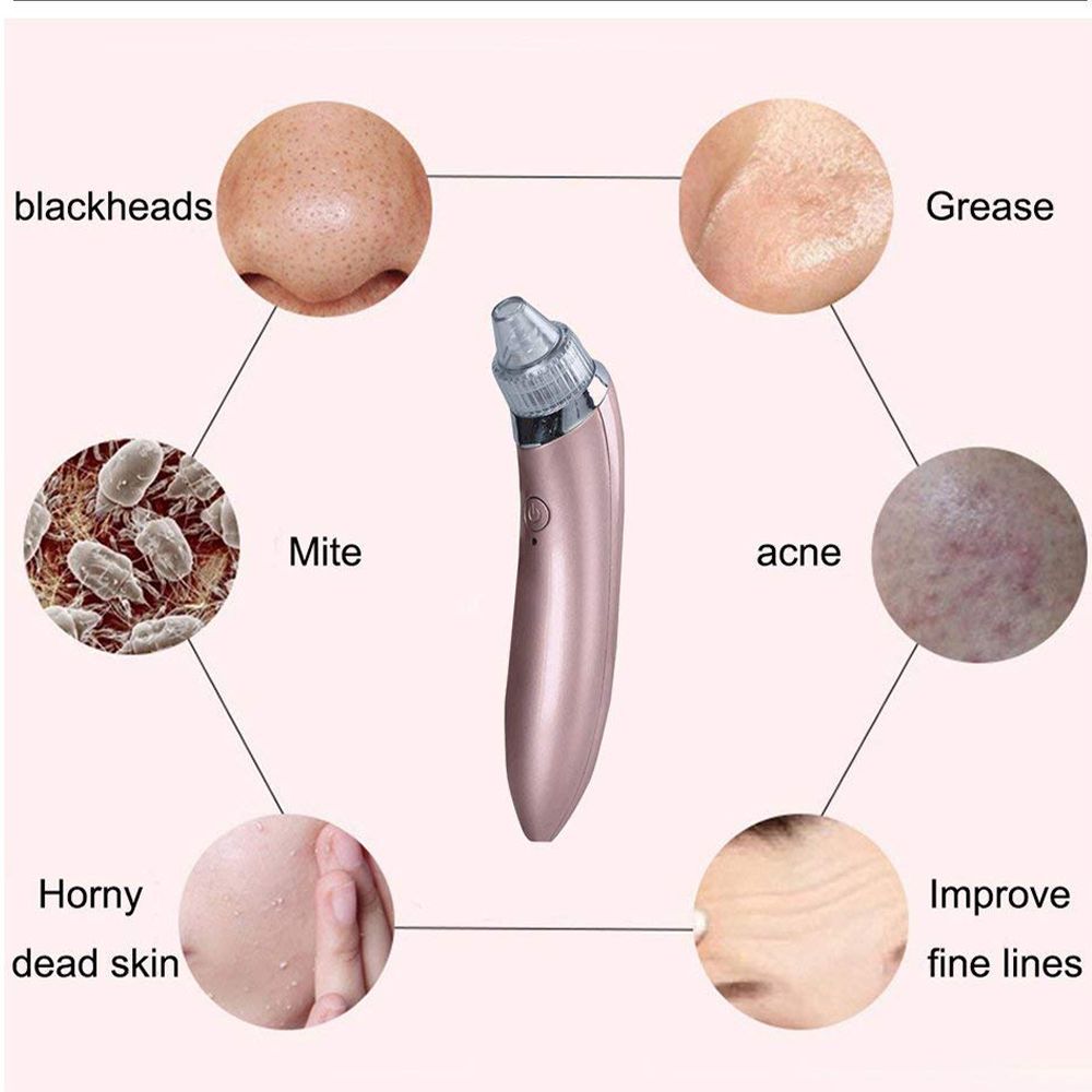 Aspiratore Punti Neri Viso Portatile con 5 Livelli e 4 Testine