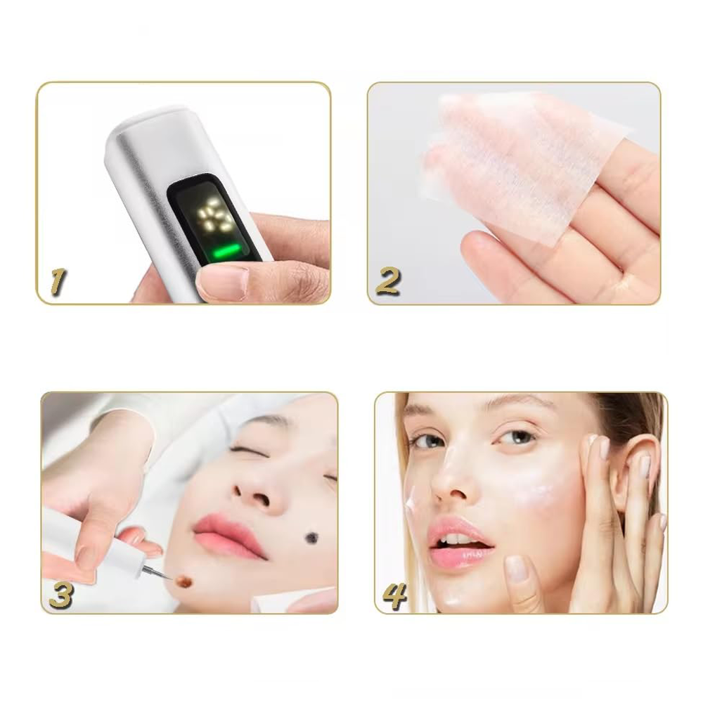 Penna Laser Plasma Estetica a 15 Livelli
