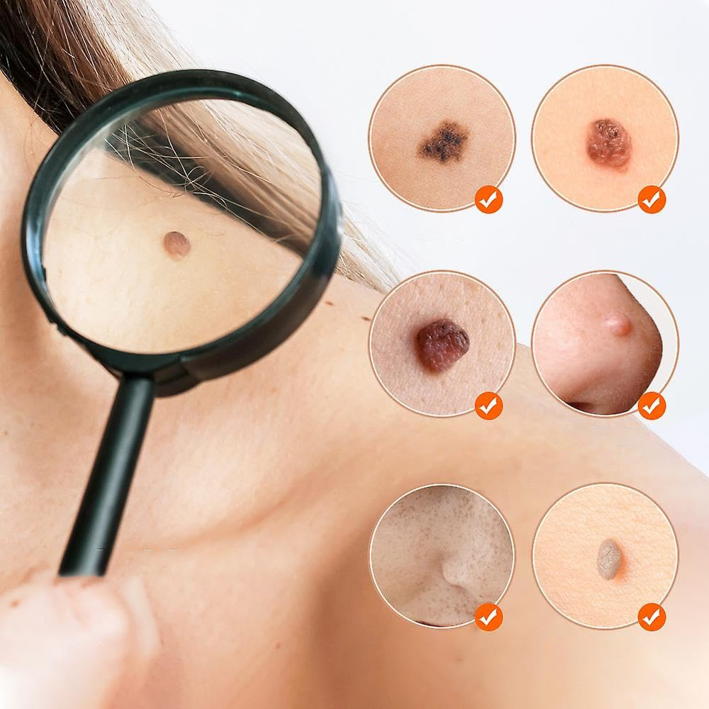 Penna Laser Plasma Estetica a 15 Livelli