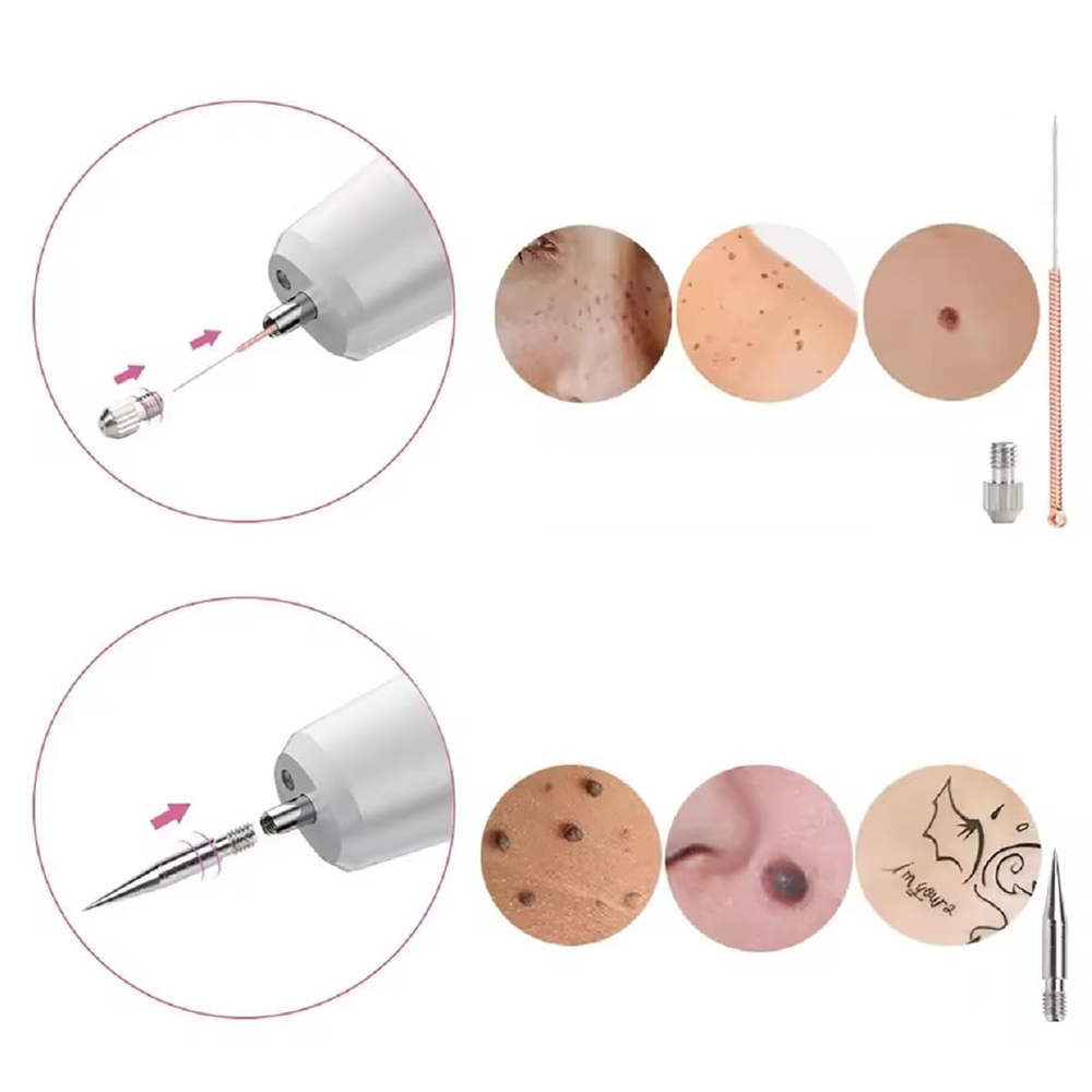 Penna Laser Plasma Estetica a 15 Livelli