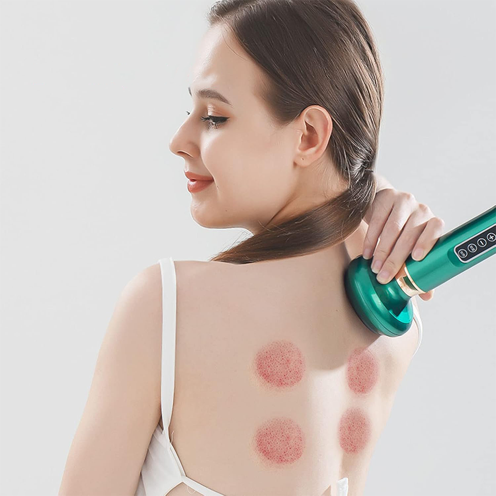 Massaggiatore Intelligente per Terapia a Coppettazione con Calore e Aspirazione Regolabile
